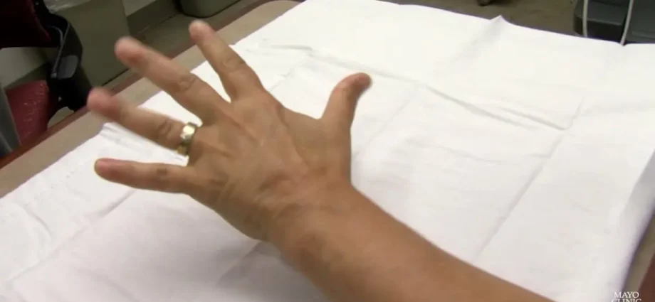 Causes of tingling on the fingers. Video
