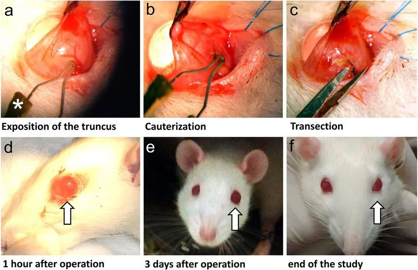 Cauterize: What is cauterization?