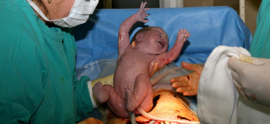 Cesarean delivery