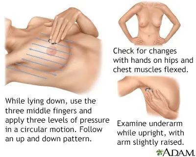 Chest hurts before menstruation: what to do? Video