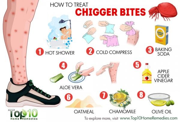 Bite Chigger: conas é a mhaolú?