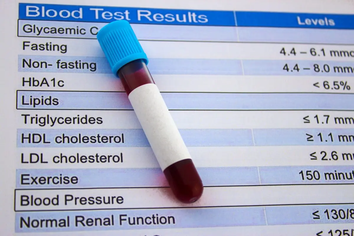 Cholesterol and triglycerides: hyperlipidemia &#8211; Our doctor&#8217;s opinion