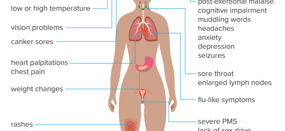 Chronic fatigue: symptoms and treatment