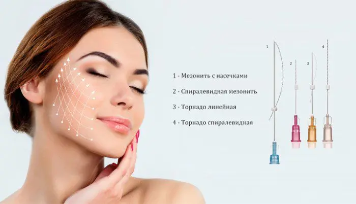 Clinic &#8220;Professional&#8221; reviews, mesothread reviews, circular facelift reviews