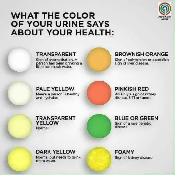 orina-turbia-qu-significa-eso-comida-sana-cerca-de-m