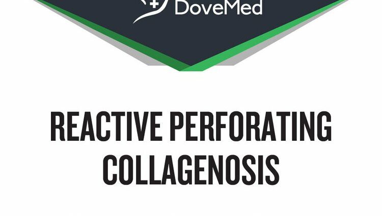 Collagenosis: definíció, okok, értékelés és kezelések