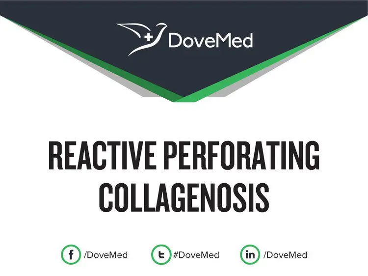 Collagenosis: definition, causes, assessment and treatments