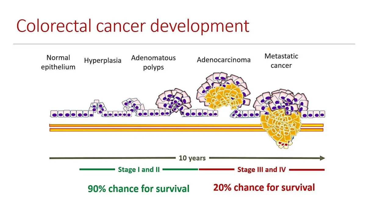 Colorectal cancer immunoassay