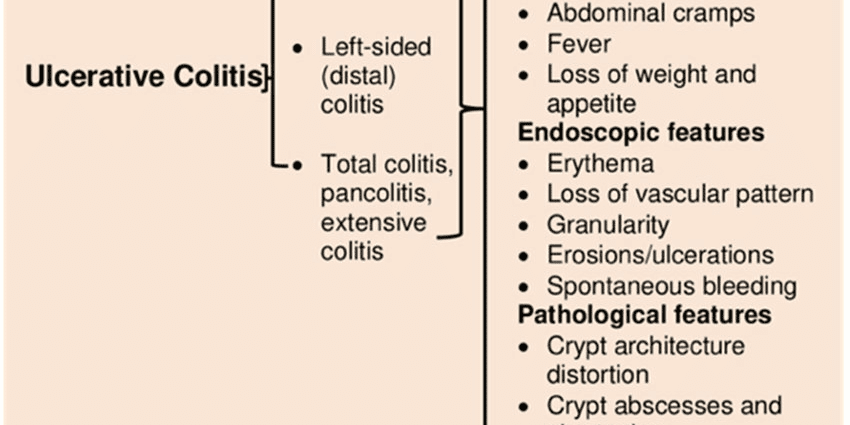 Colitis ulcerative colitis completiva accedit