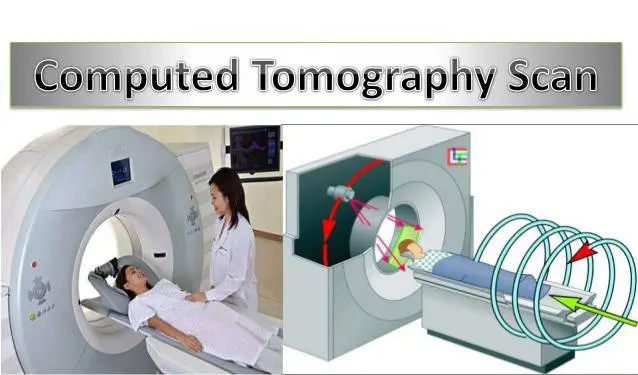 Computed tomography: all you need to know about this medical examination