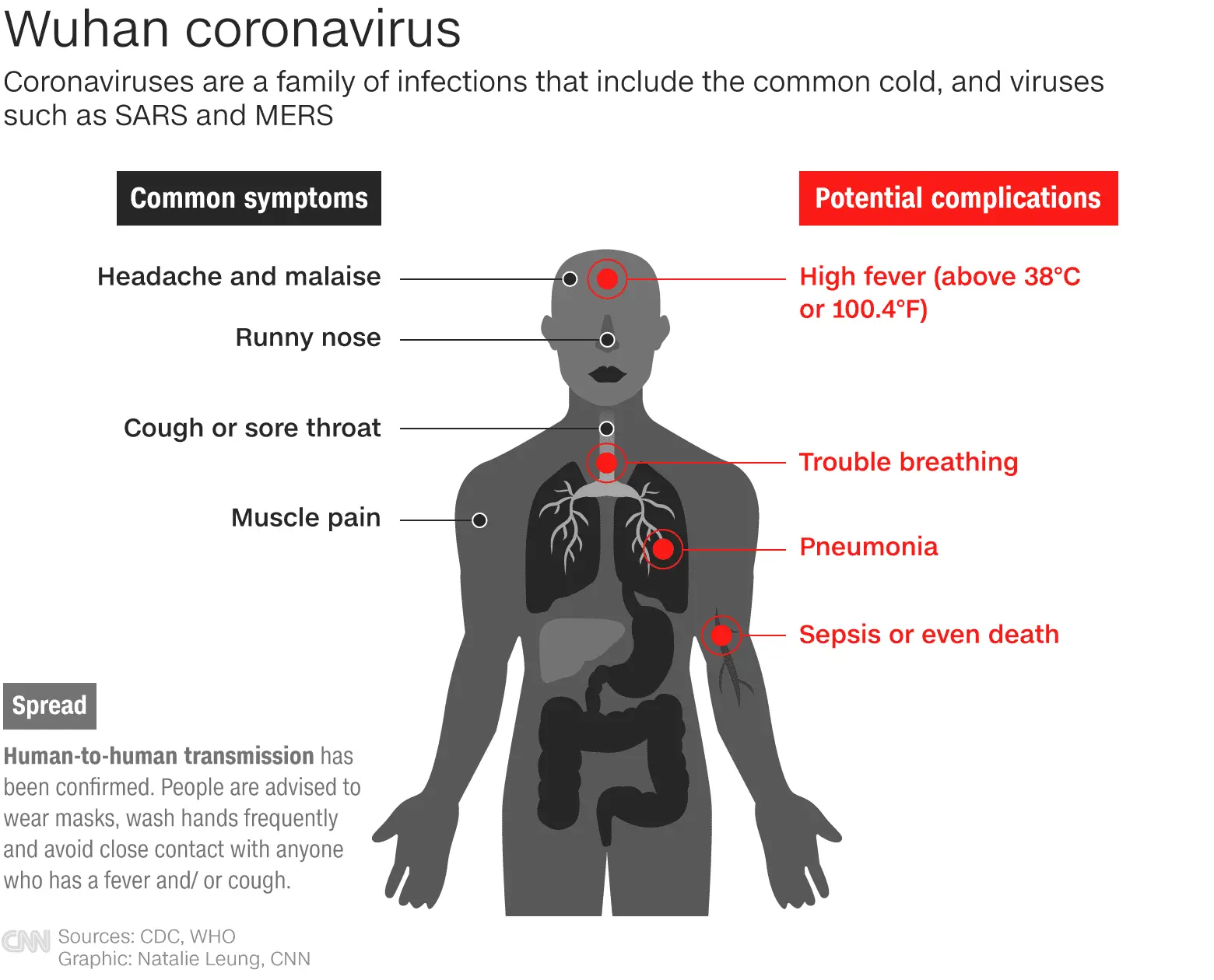 Coronavirus How to avoid body pain from not exercising at home