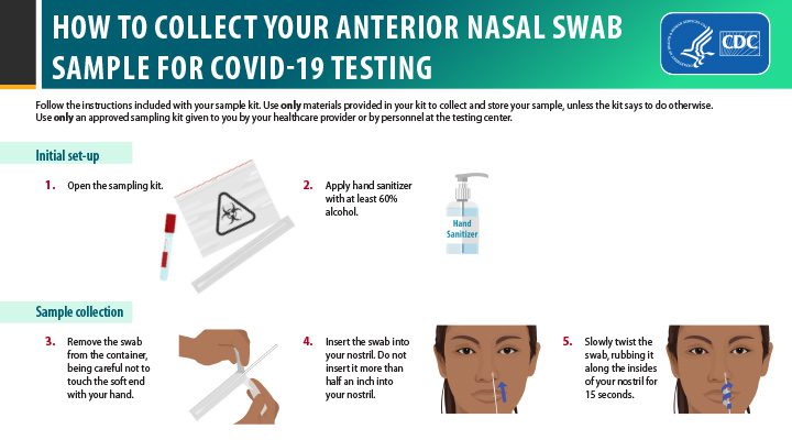 Coronavirus tests: how to get tested today in France?