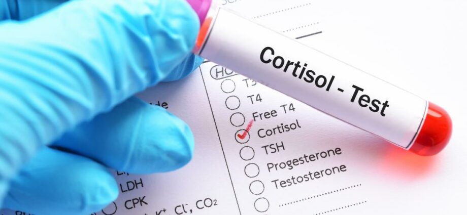 သွေးထဲတွင် Cortisol