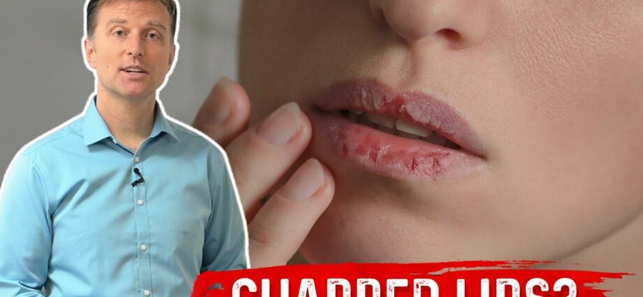 Cracked lips: causes and treatment. Video