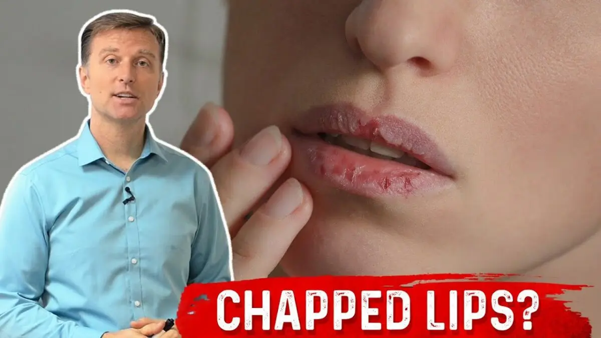 Cracked lips: causes and treatment. Video