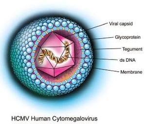 Mycobacterium intracellulare (CMV)
