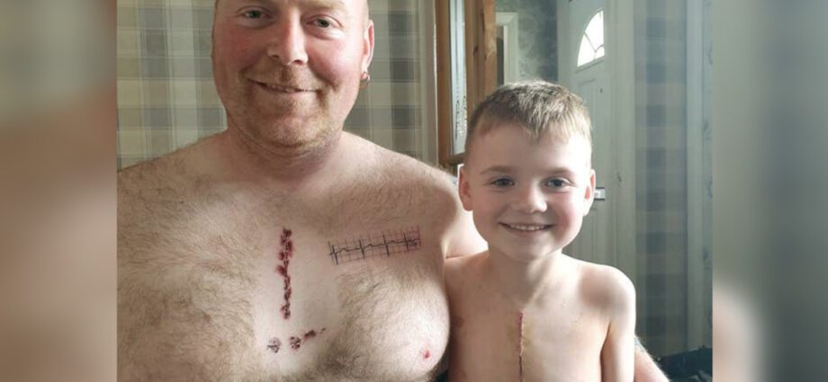 Dad can do anything: father made himself a scar tattoo in support of his son