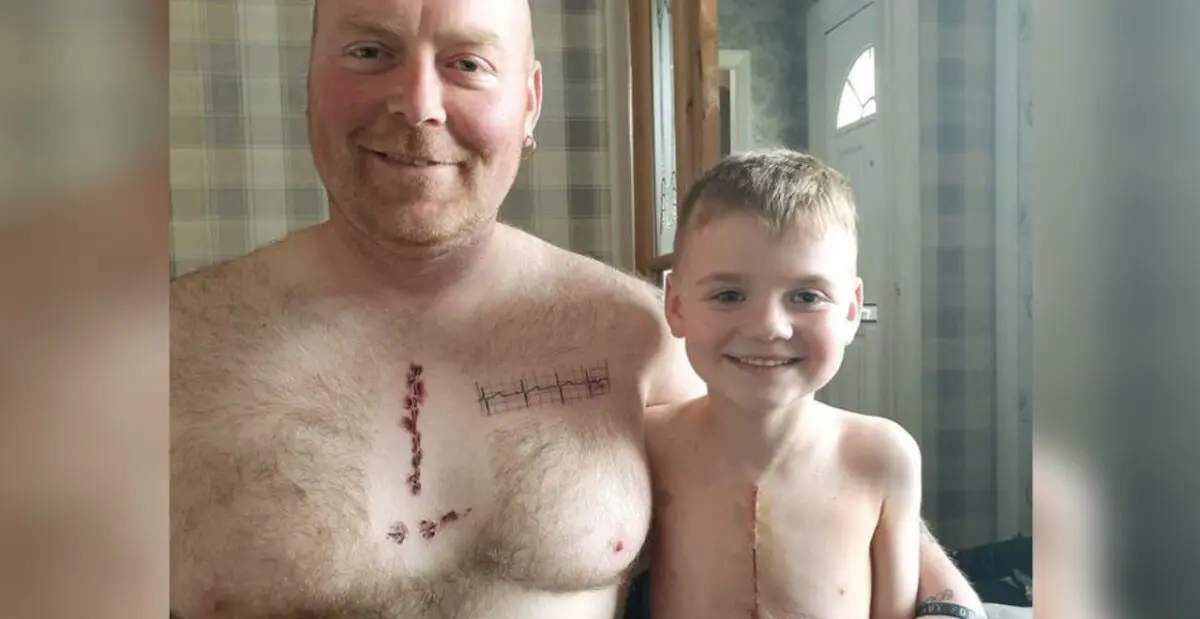 Dad can do anything: father made himself a scar tattoo in support of his son