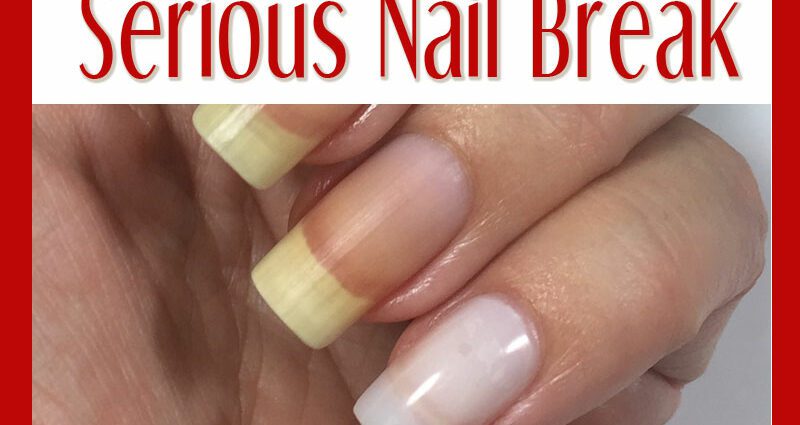 Damaged nails, broken nails: give strength to brittle nails