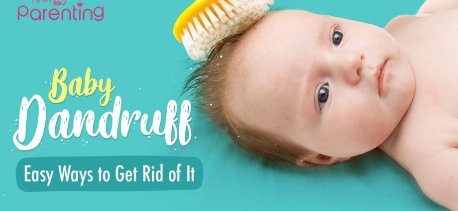 Dandruff in children: causes and treatment. Video