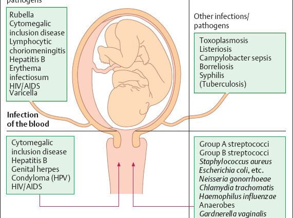 Dangerous infections during pregnancy, intrauterine infection