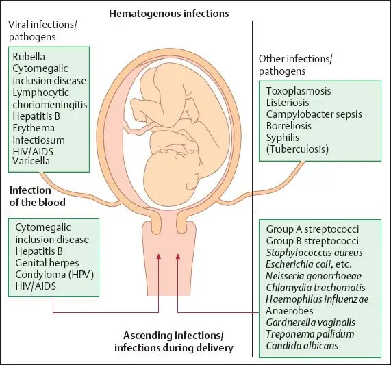 E. coli during pregnancy: danger, effect on the fetus, treatment