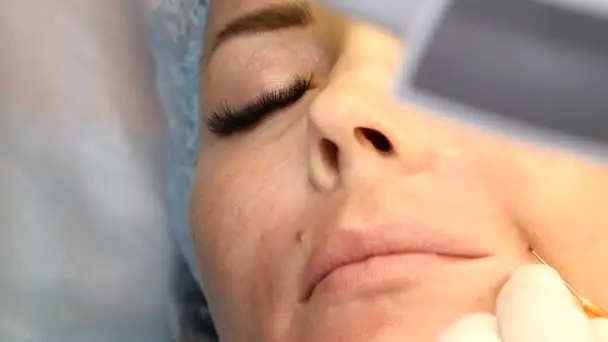 Dealers in cosmetology: injection facial plastic. Video