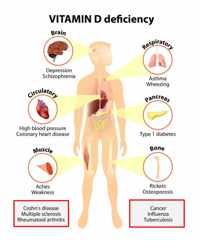 Deficiency and lack of vitamins: how to recognize? Video