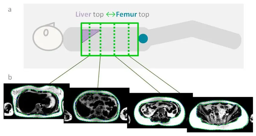 Definition of abdominal MRI