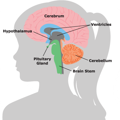 Definición de resonancia magnética cerebral