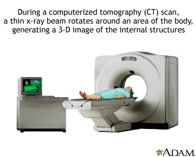 Definition of chest scanner