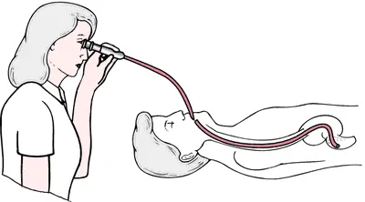 Definition of digestive endoscopy