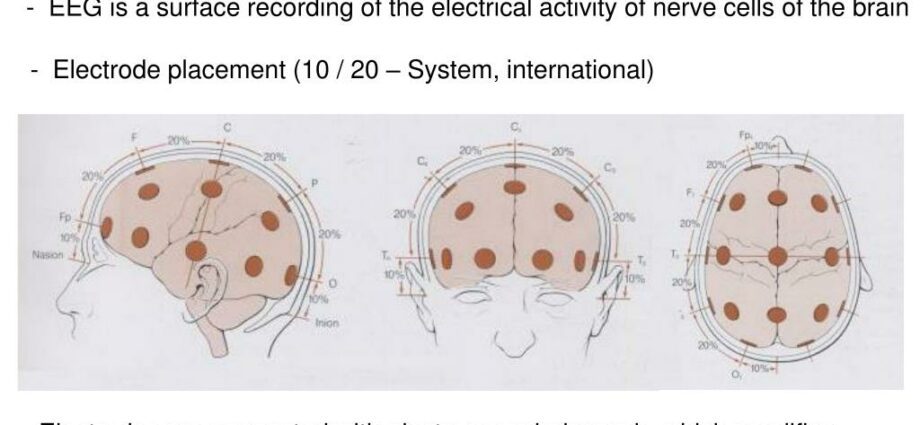 Definícia elektroencefalogramu