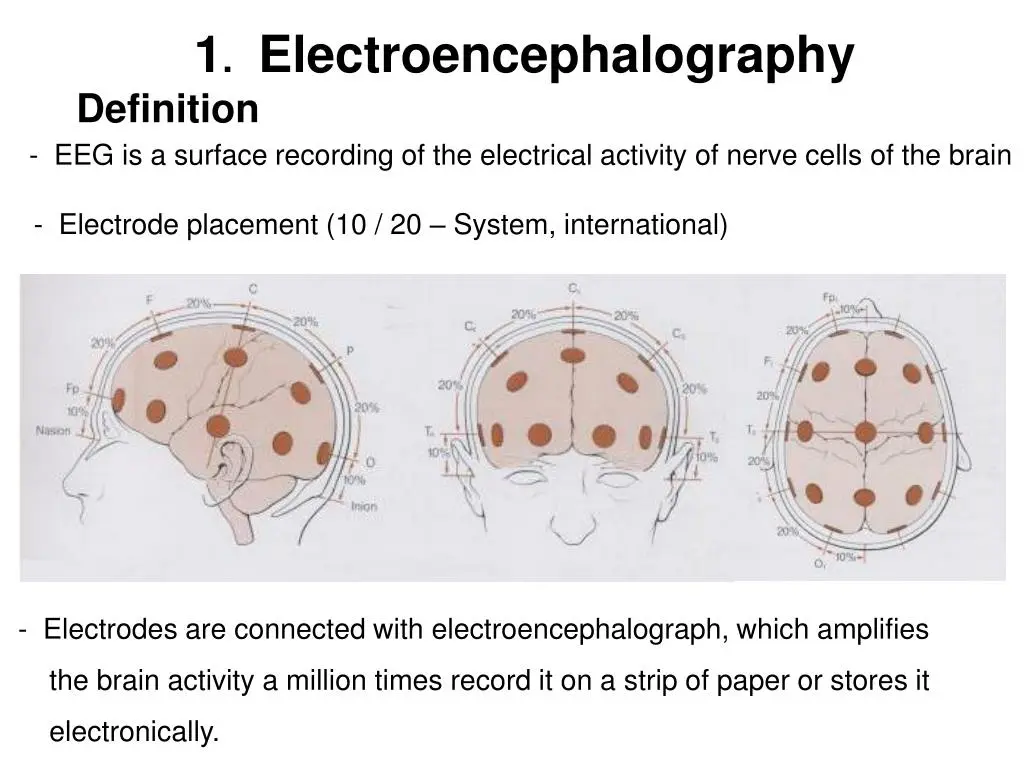 Definition of electroencephalogram