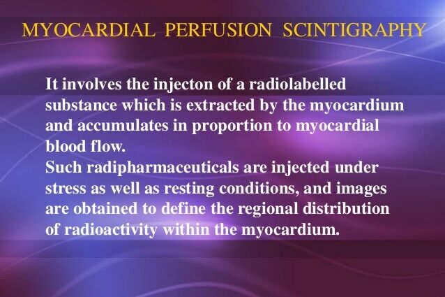 Definición de gammagrafía cardíaca