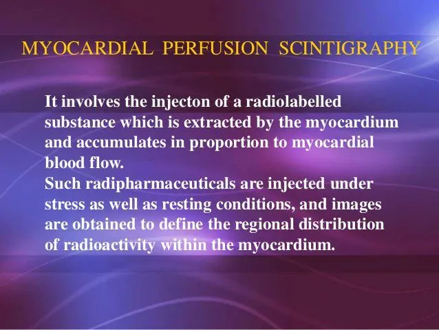 Definition of heart scintigraphy