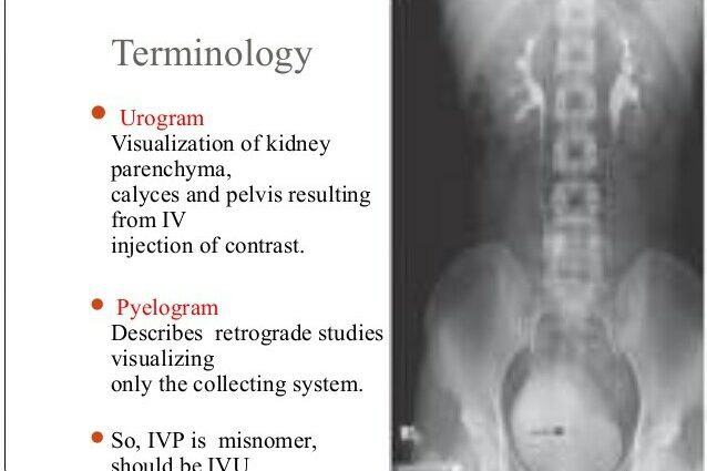 Definition of intravenous urography