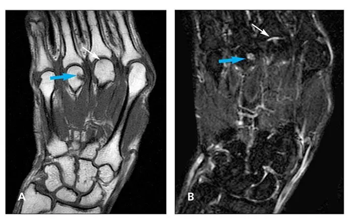 Definition of MRI in rheumatology