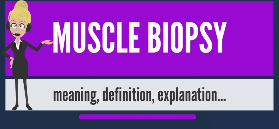 Definición de biopsia muscular