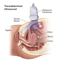 Famaritana ny ultrasound pelvic