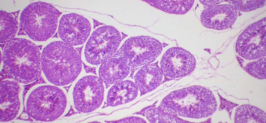 Përkufizimi i biopsisë testikulare