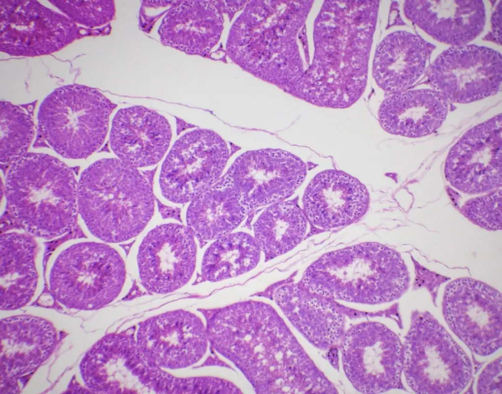 Definition of testicular biopsy