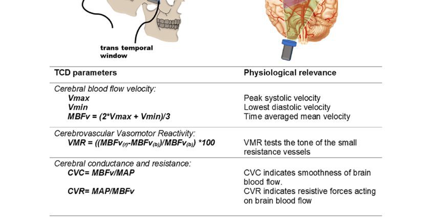 Sainmhíniú ar doppler transcranial