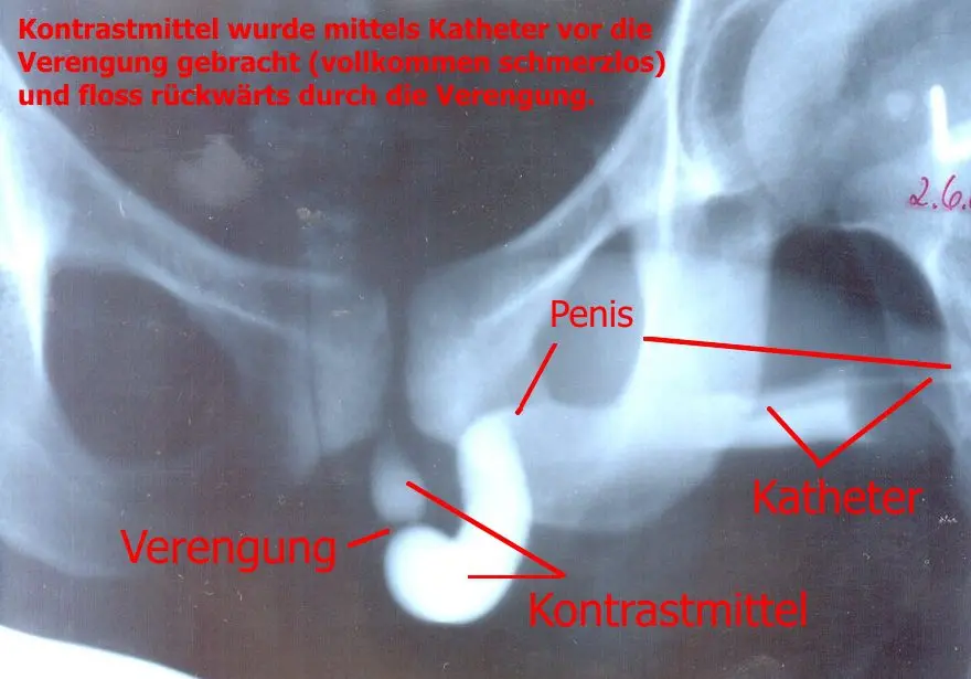 Definition of urethrocystography