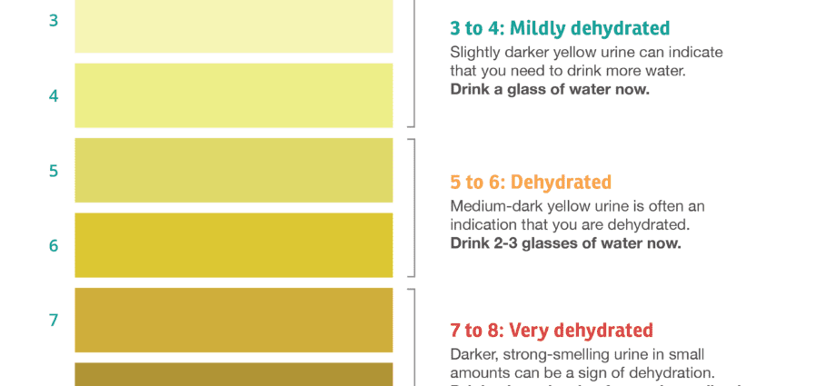 Dehydration &#8211; Causes, Symptoms, Treatments
