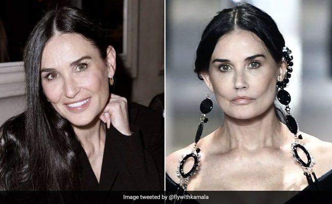 Demi Moore plastic surgery