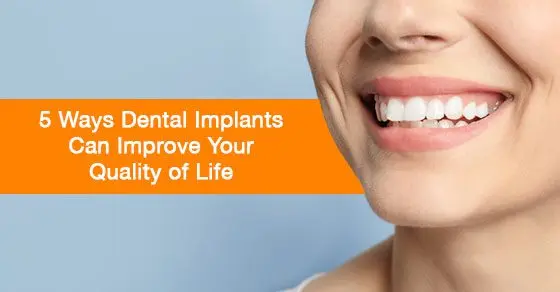 Dental implants: quality prosthetics for a lifetime