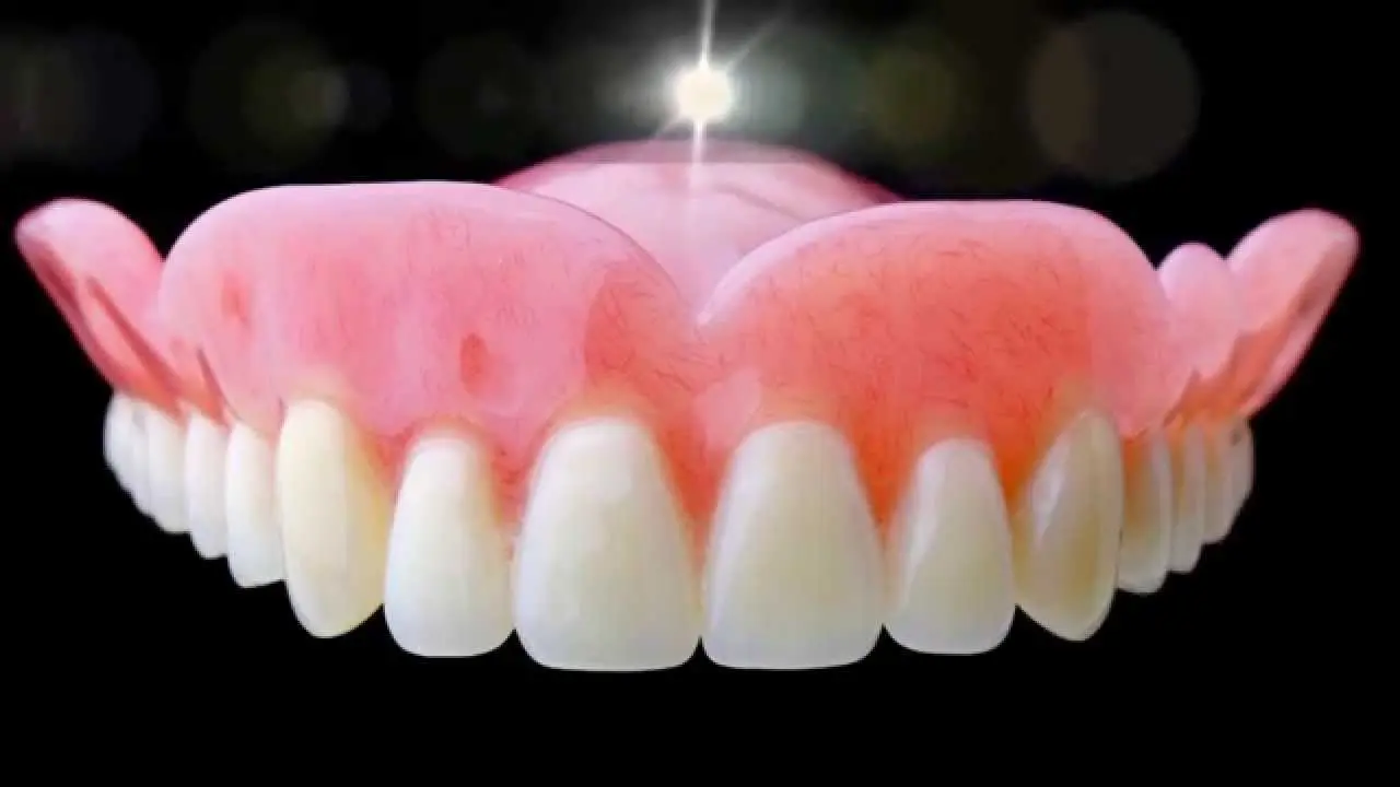 Dentures: all you need to know about this dental prosthesis