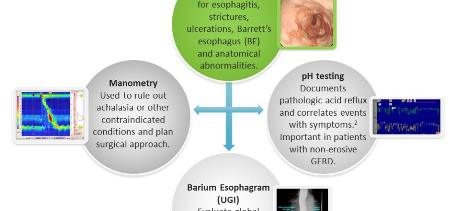 Gastroezofaginio refliukso ligos (rėmuo) diagnozė