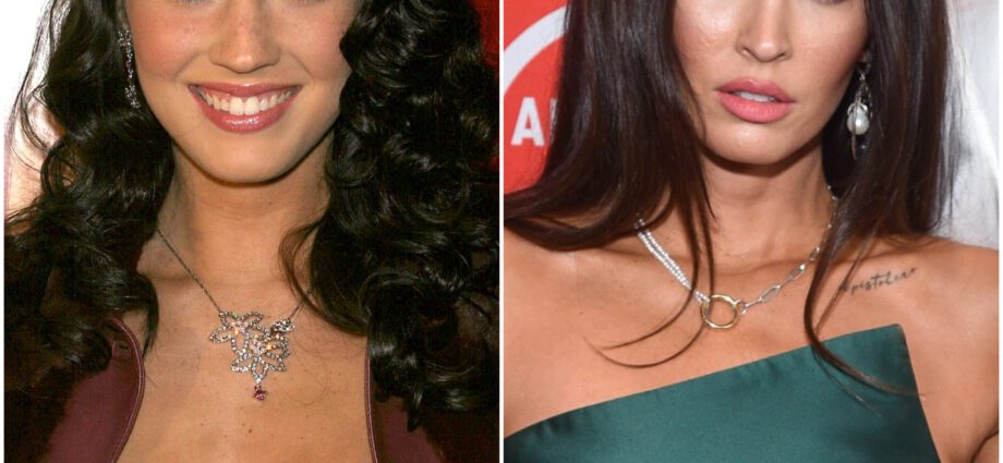 An bhfuair Megan Fox shots Botox?